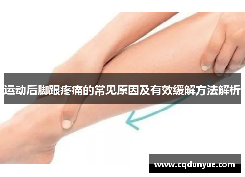 运动后脚跟疼痛的常见原因及有效缓解方法解析